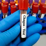 AVC silencioso é 10 vezes mais comum do que os sintomáticos e pode causar demência progressiva