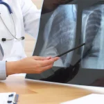 Saiba como identificar se seu esmalte em gel contém substâncias proibidas pela Anvisa