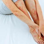 Dia mundial da luta contra a Aids: Relembre filmes e séries que abordam o tema