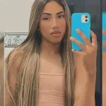 Vera Viel revela sequelas após cirurgia para retirar tumor raro e maligno