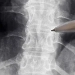 Sintomas inesperados que indicam que seu coração não está bem