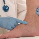 Gilmar Mendes dá 48 horas para SC explicar lei que proíbe cotas raciais em universidades