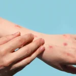 Fachin procura ministros para tentar tirar STF da crise do Banco Master