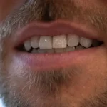 Shia LaBeouf é condenado a fiança de US$ 100 mil e a fazer reabilitação