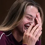 Suzanna Freitas abre o jogo sobre os desafios de conviver com hiperidrose