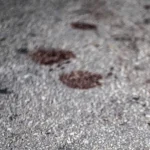 Sorriso desalinhado? Vejas 6 problemas que vão além da saúde bucal