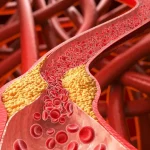 Mulher é encontrada morta e decapitada em Mogi das Cruzes (SP)