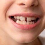 Empresa de MrBeast é processada por assédio sexual e discriminação