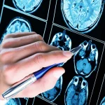 Congresso reprova ou caduca 77% das MPs de Lula; taxa de aprovação é a menor desde 2001