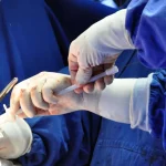 Gordura no fígado? Especialista revela os alimentos que ajudam a limpar