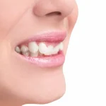 Fim da escala 6×1 é principal bandeira nos atos do 1° de Maio no país