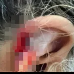 Google lança app de edição de imagens com Inteligência Artificial