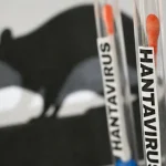 As características mais raras e perigosas no olho humano